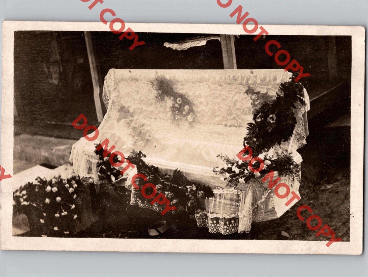 1916 Deceased Man Post Mortem Open Casket Johnnie Munson BIRMINGHAM Iowa IA RPPC