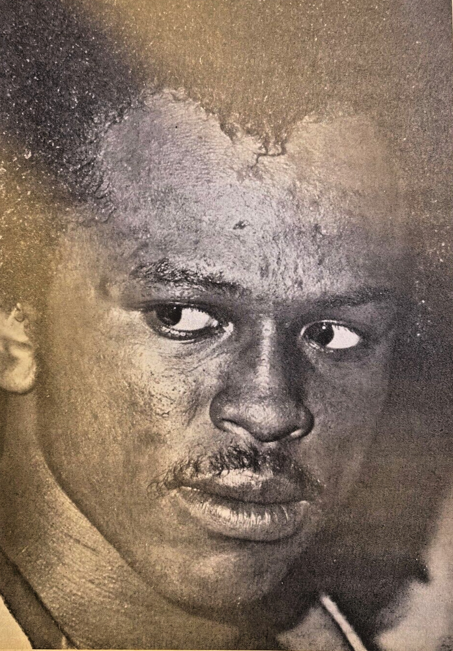 1982 Boxer Michael Dokes