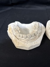Weird Vintage 1970’s Molded Teeth Impressions Molded For Dentures. picture